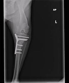 TPLO Post-op VD